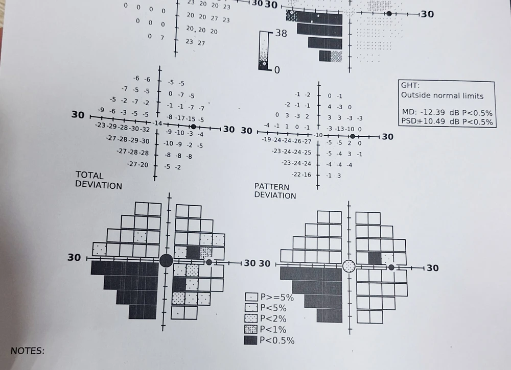 Tiêm filler thẩm mỹ