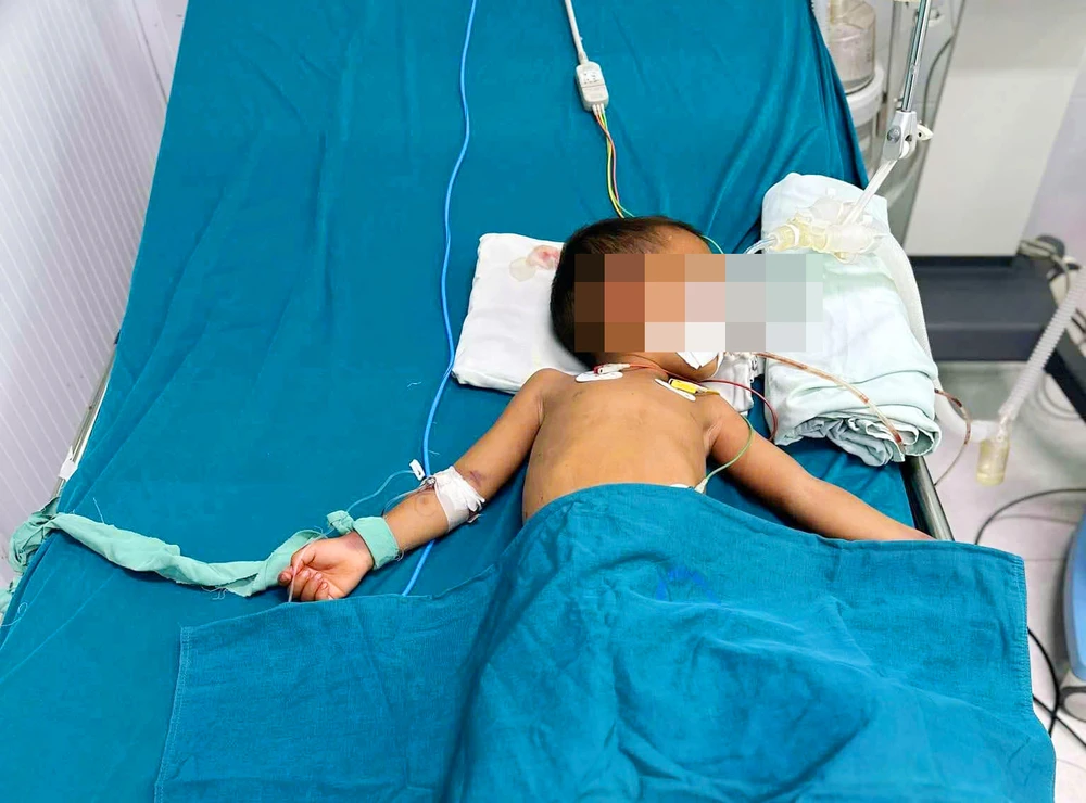 Cháu bé 4 tuổi bị rắn lục đuôi đỏ cắn gây rối loạn đông máu, xuất huyết não