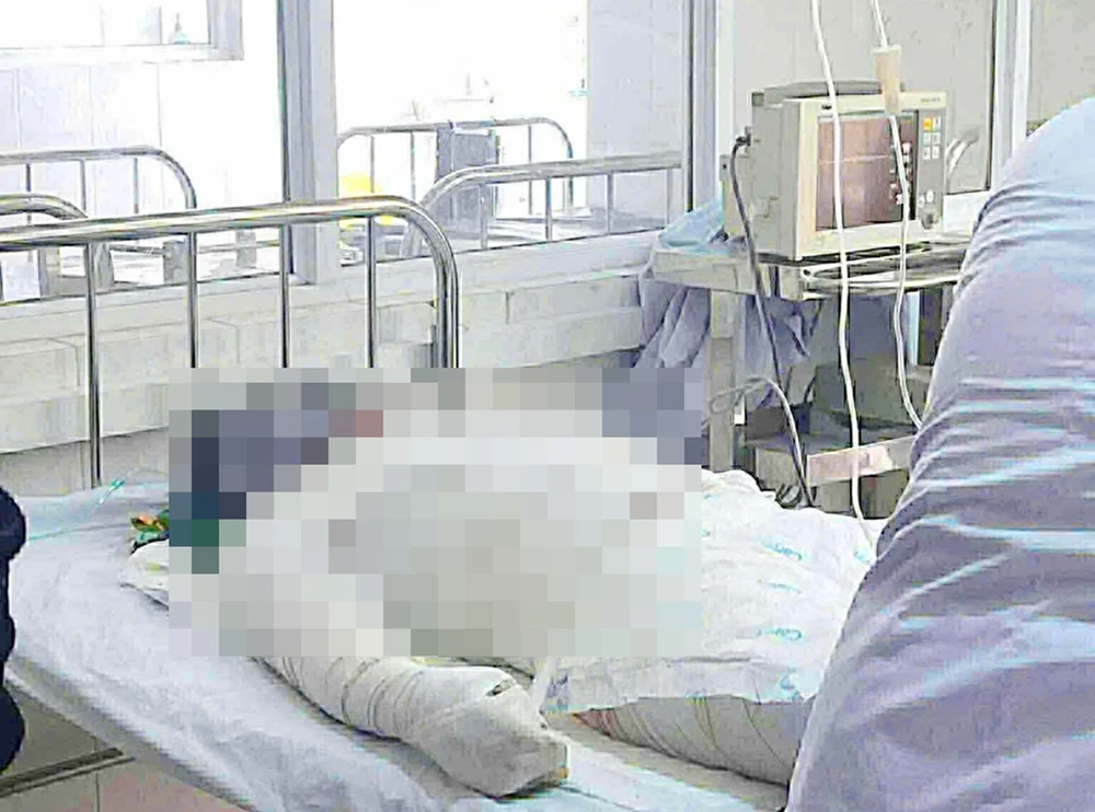 Nạn nhân thứ hai trong vụ phóng hỏa đốt nhà xảy ra ở phường An Khê, tỉnh Gia Lai đã tử vong sau nhiều ngày tích cực điều trị.