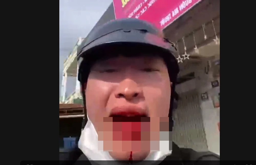 Công an phường Buôn Ma Thuột (tỉnh Đắk Lắk) đang vào cuộc xác minh, điều tra vụ việc người đàn ông chặn xe, đánh người gây thương tích.