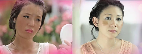 Dưỡng sáng hồng da điều trị triệt để nám má, sạm da ảnh 1