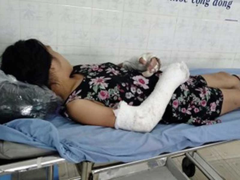 Vụ ‘võ sư’ đánh vợ: Công an làm việc với người chồng ảnh 2