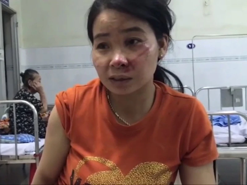 Bộ Công an vào cuộc vụ sập tường 10 người chết ảnh 3