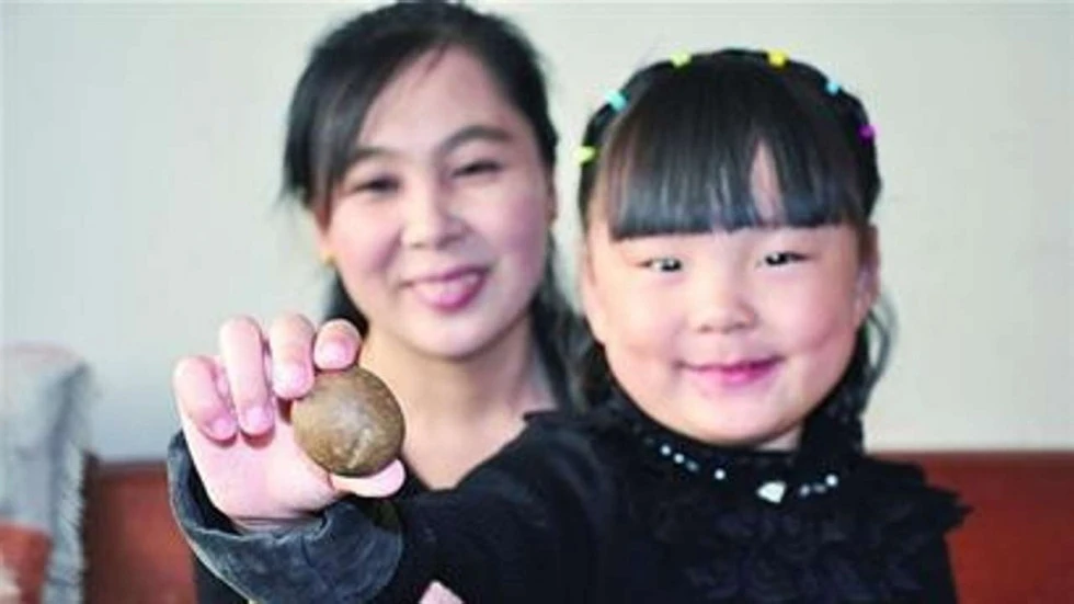 Người nhà người đàn ông khoe viên sỏi quý được tìm thấy trong gan con cừu cái. Ảnh: SCMP