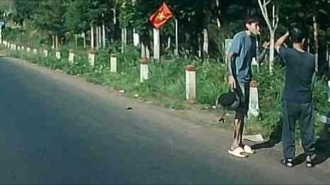 Khởi tố một bị can vô cớ đánh người đi đường chấn thương sọ não