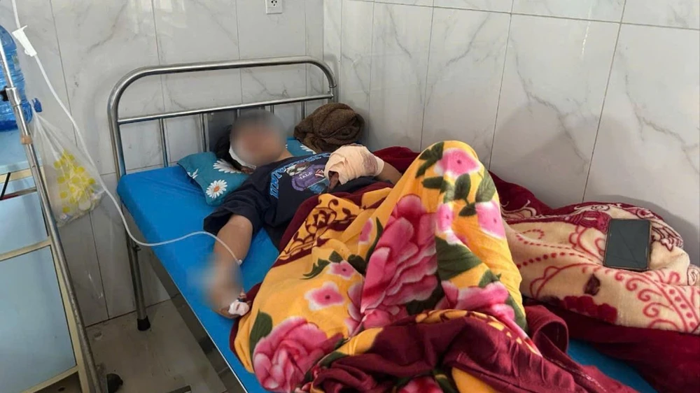 tai nạn pháo nổ 9.jpg