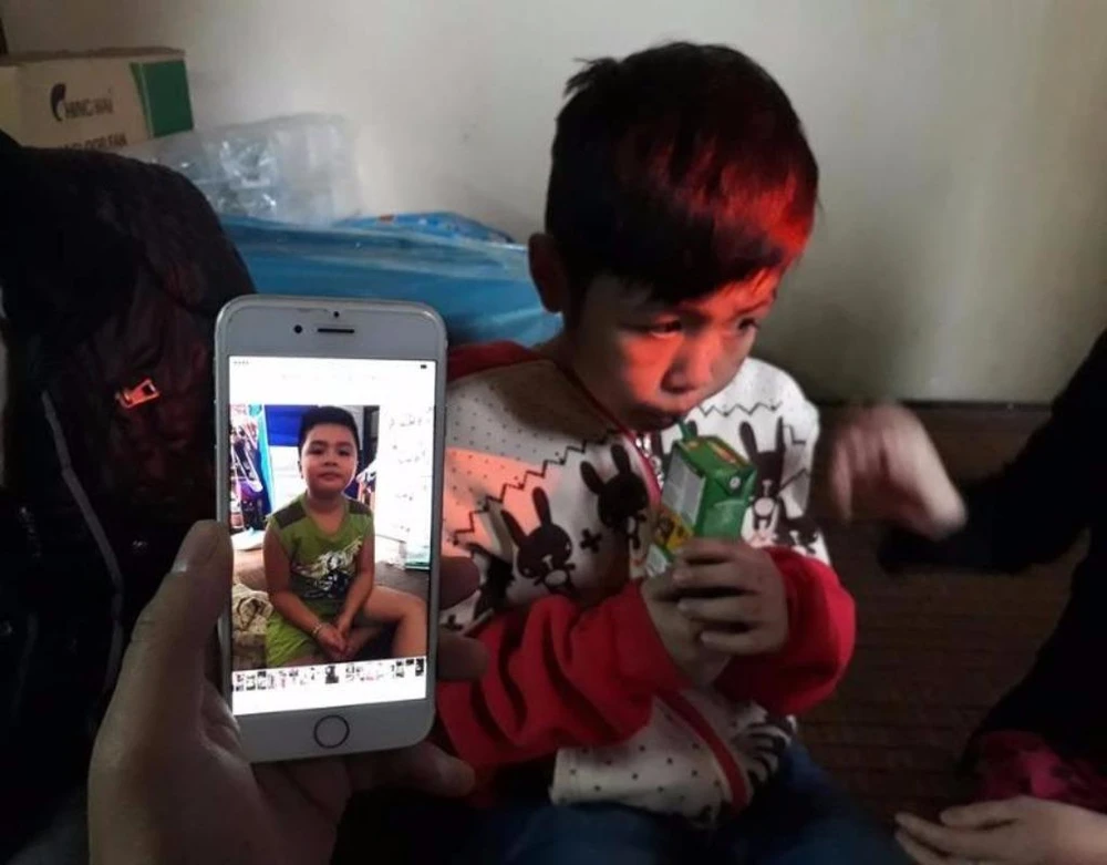 Cháu bé 10 tuổi bị rạn hộp sọ sau khi bị cha bạo hành.