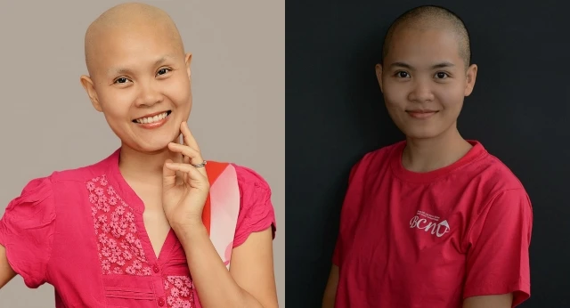 Tự sự xúc động của cô gái đầu trọc về người chị qua đời vì ung thư vú ảnh 3