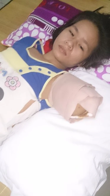 Nạn nhân Trần Thị Yến trên giường cấp cứu tại Bệnh viện chấn thương chỉnh hình Nghệ An - Ảnh: CTV