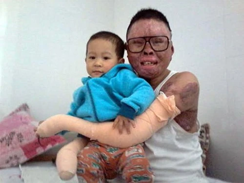 Chiến sĩ duy nhất sống sót trong vụ rơi máy bay tại Hòa Lạc giờ ra sao? ảnh 1