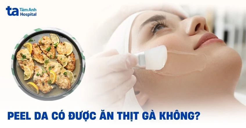 peel-da-co-duoc-an-thit-ga-khong.jpg