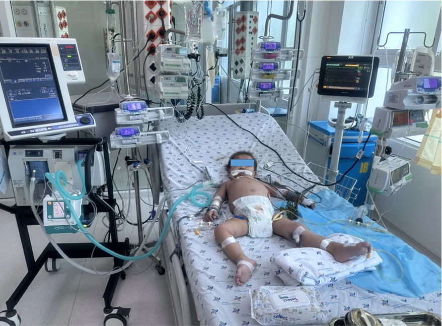 Bé trai 27 tháng tuổi bị sốc sốt xuất huyết dengue ngày 4. Ảnh: BVCC