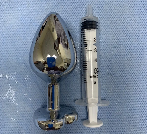 Đồ chơi tình dục được lấy ra từ hậu môn của bệnh nhân. Ảnh: BVCC