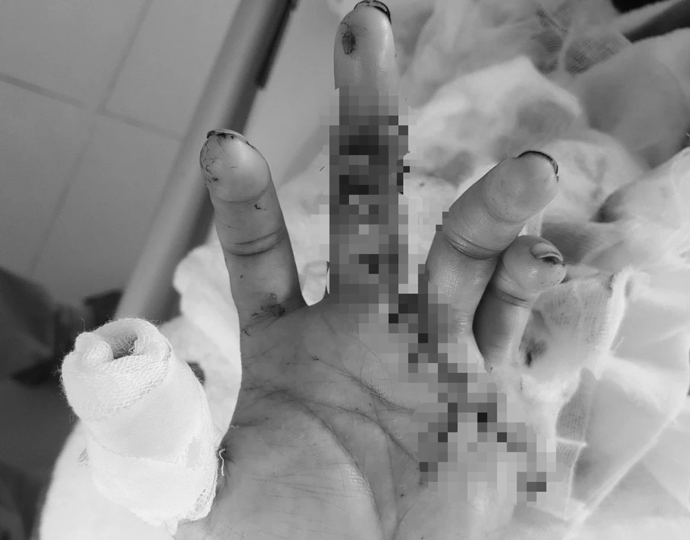 noi-ngon-tay1 (2).jpg