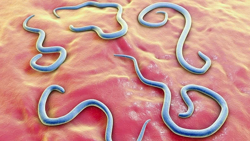 gắp hơn 100 con giun đũa - 1