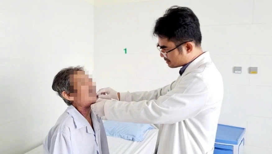 ung thư lưỡi - 1