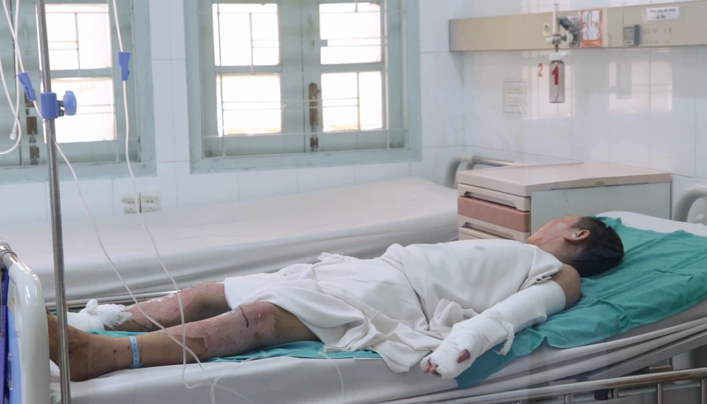 bị tai nạn do tự chế pháo - 1