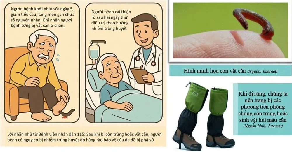 nhiễm trùng huyết