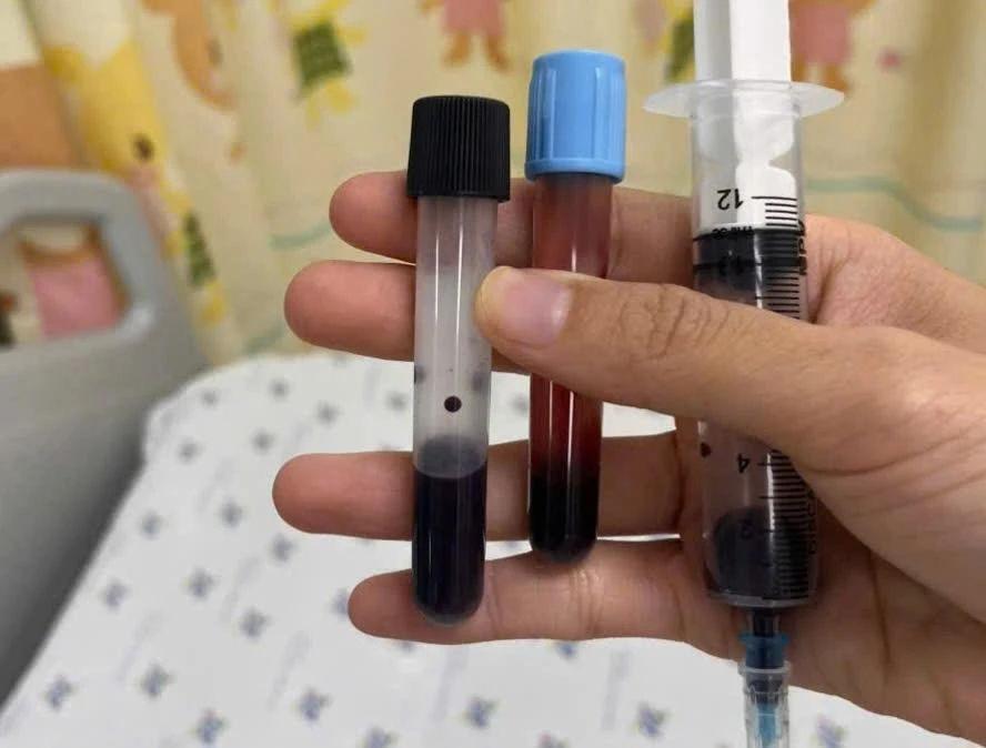 ngộ độc methemoglobin