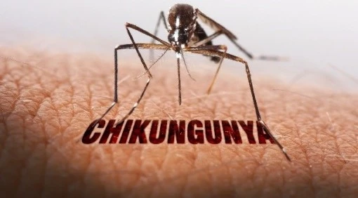 dịch bệnh Chikungunya