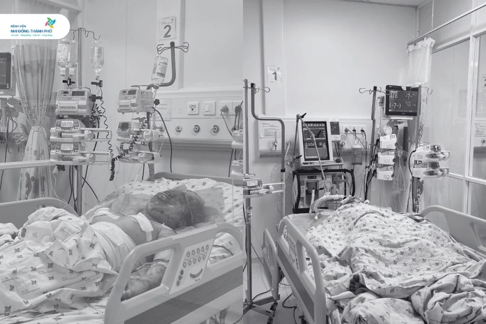 Hai chị em bị bỏng nặng