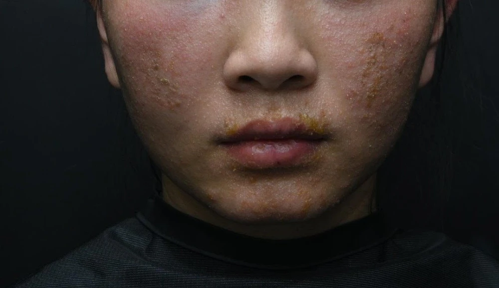 sử dụng mỹ phẩm kém chất lượng