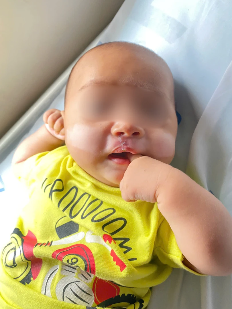 di-tat-khe-ho-moi (2).png