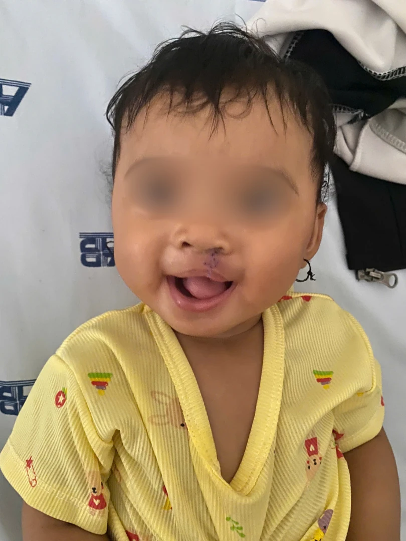 di-tat-khe-ho-moi (3).png