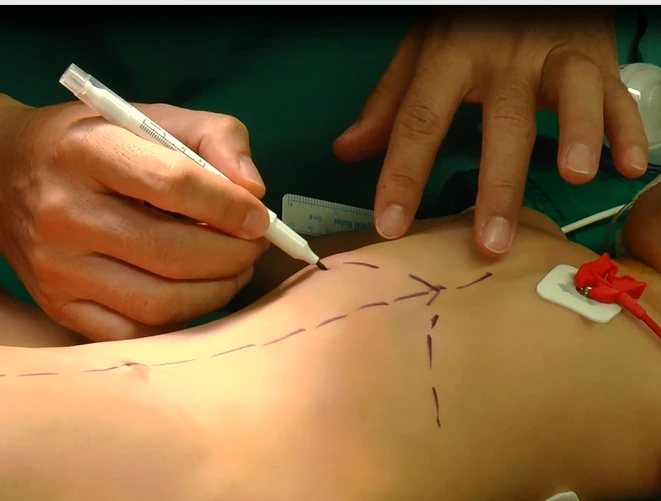 Nhìn lại hành trình tách rời cặp song sinh Trúc Nhi - Diệu Nhi ảnh 8