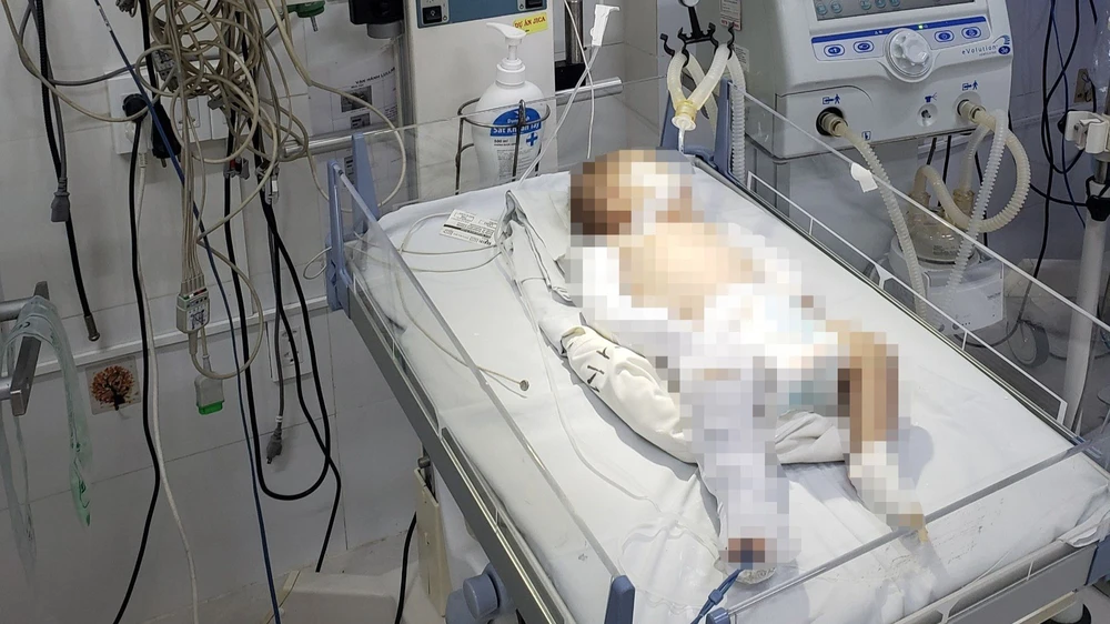 Cháu bé hơn 2 tháng tuổi bị bạo hành dã man. Ảnh: VTT