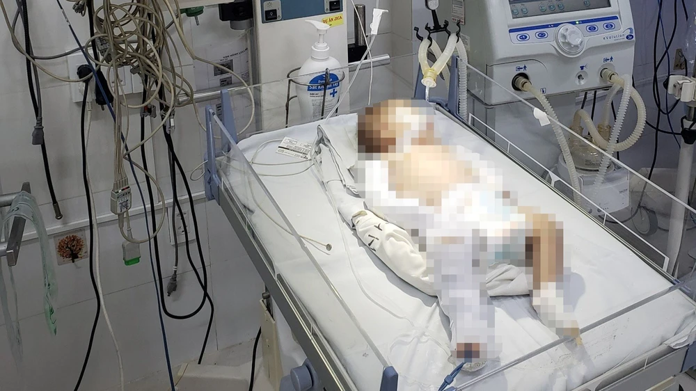 Cháu C. đang được điều trị tích cực tại bệnh viện. Ảnh: VTV