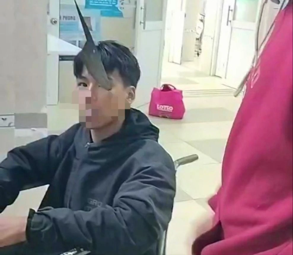 Biểu diễn múa dao, thiếu niên bị dao cắm vào hốc mắt