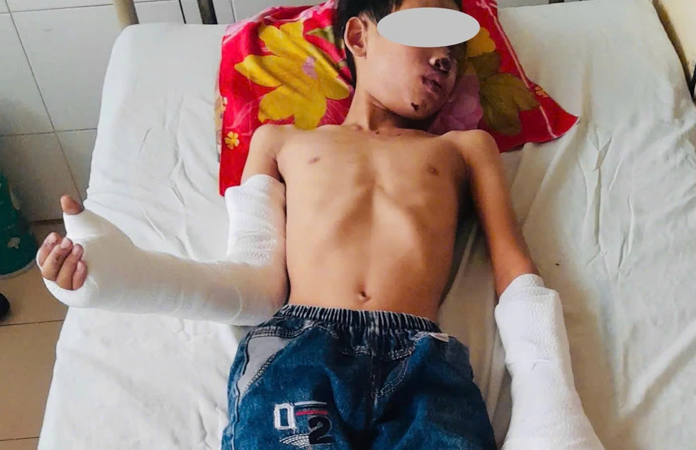 tự chế tạo pháo.jpg