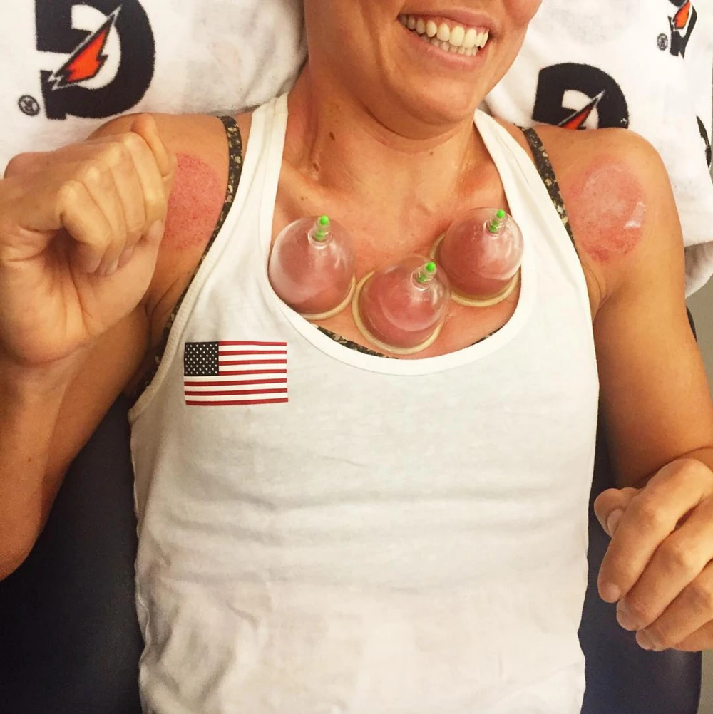 kỹ thuật chữa bệnh được các vận động viên ưa chuộng