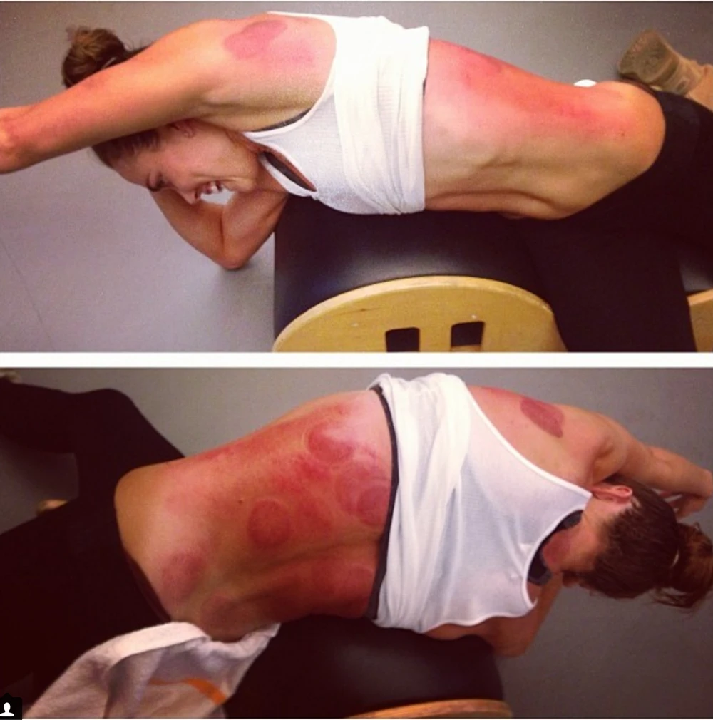 động viên bơi lội người Mỹ Natalie Coughlin