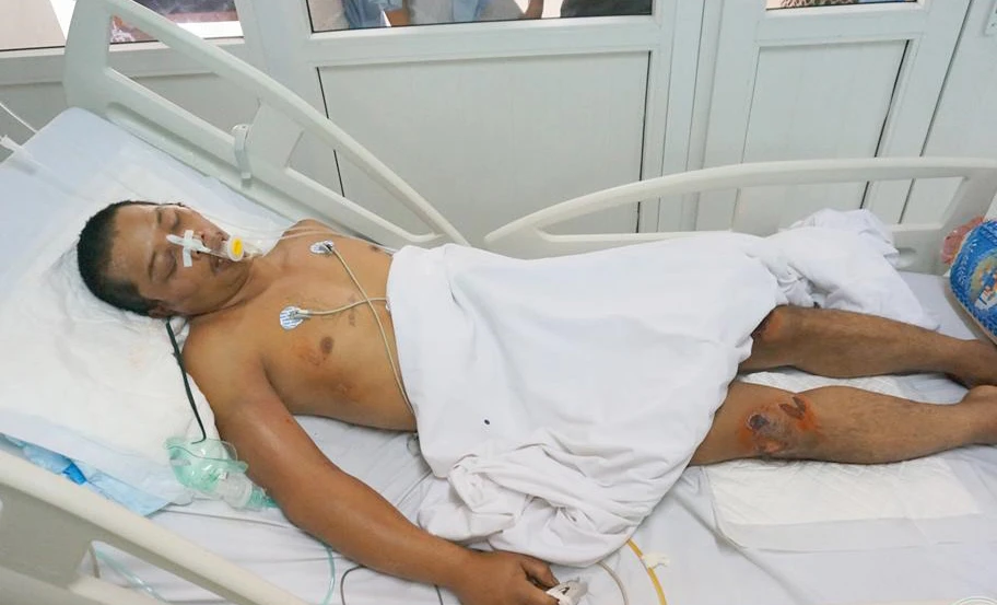 Cảnh sát tìm tung tích nam nạn nhân có xăm chữ “không hận” trước ngực ảnh 2