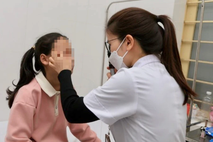 cạo đầu que diêm bỏ vào cối giã, bị bỏng hai mắt