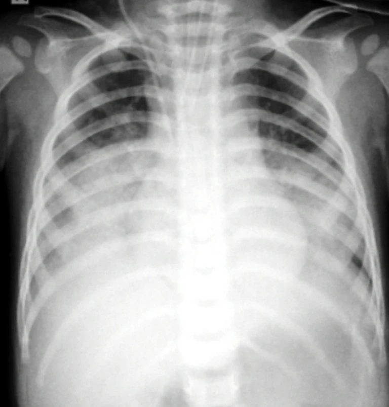 Uống nhầm dầu thắp đèn