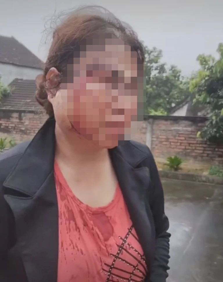 Con ủng hộ mẹ ‘đi bước nữa’ nhưng mẹ bị chồng trẻ bạo hành dã man