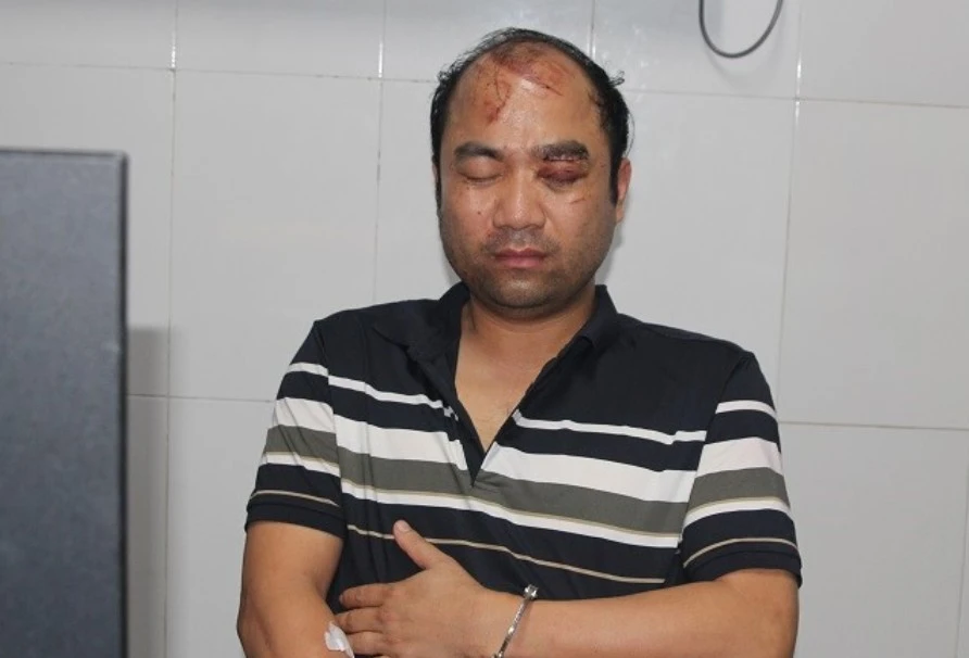 tai-nan-dau-long (2).jpg