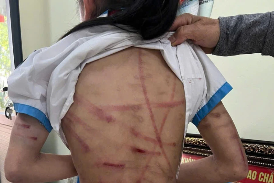 lớp 5 bị bạo hành.jpg