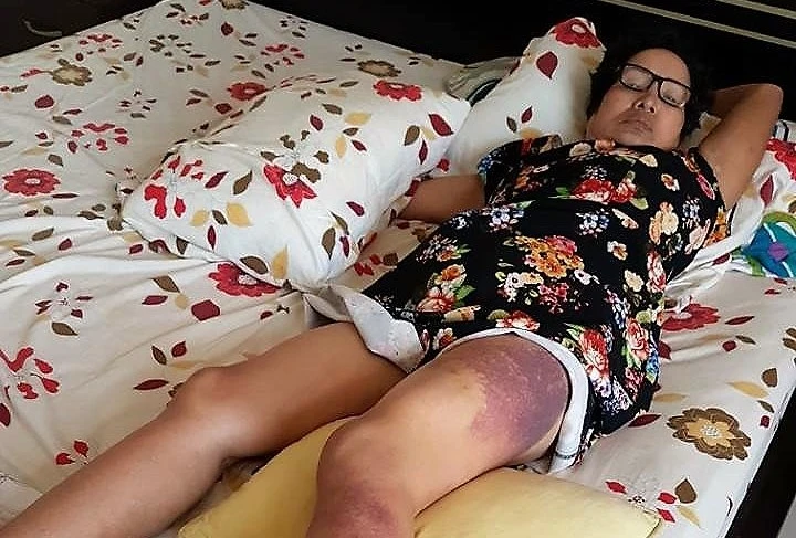 Tòa làm việc với người tố bị thẩm phán đạp vào đùi ảnh 1