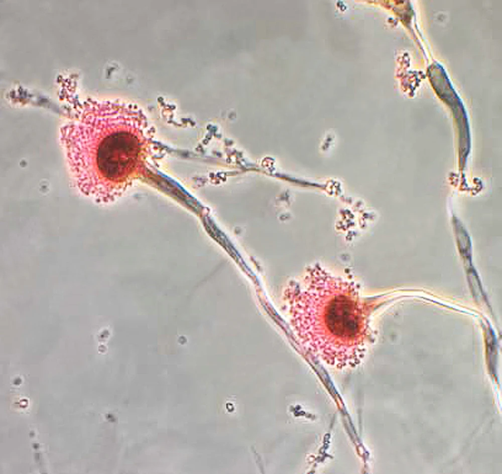 Loài vi nấm Aspergillus Fumigatus phổ biến nhất có thể mở rộng phạm vi lây lan nhờ biến đổi khí hậu.jpg