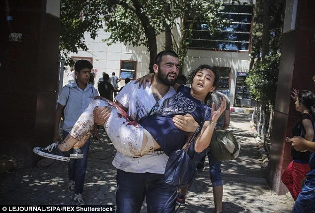 Chùm ảnh đau thương vụ đánh bom tự sát tại Thổ Nhĩ Kỳ ảnh 7