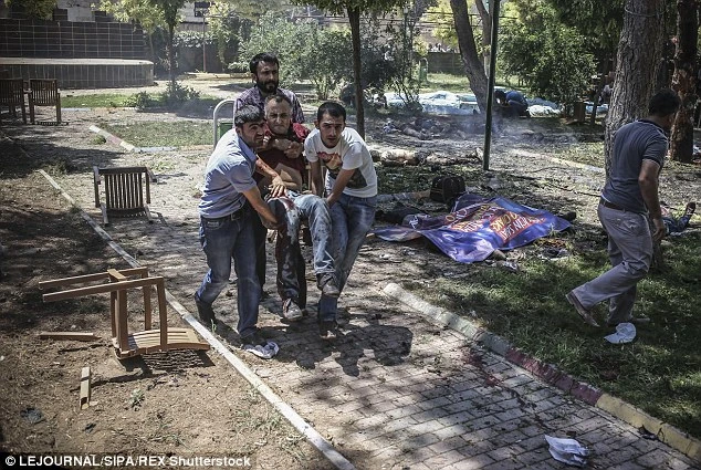 Chùm ảnh đau thương vụ đánh bom tự sát tại Thổ Nhĩ Kỳ ảnh 8