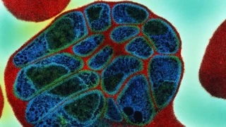 Nguyên nhân phát triển bệnh sốt rét đã được phát hiện ảnh 1