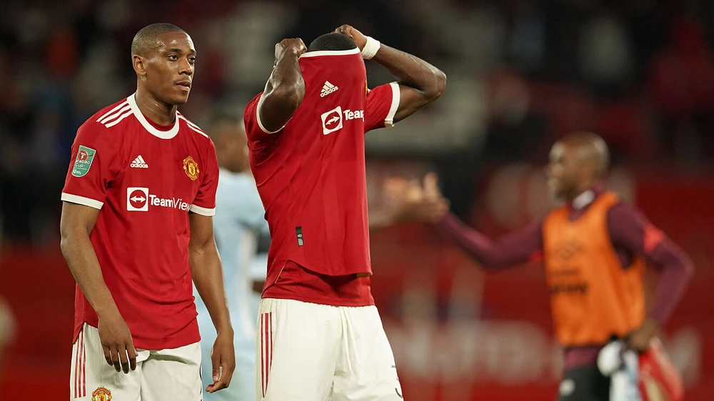 Martial bị chấn thương nhiều khiến anh không còn chỗ đứng ở Old Trafford. Ảnh: GETTY.