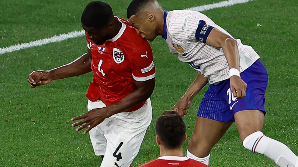 Mũi của Mbappe không ổn chút nào