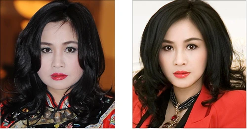 Ngoài ra, diva còn sử dụng phương pháp Thermage để chống lại lão hóa và tuổi tác.