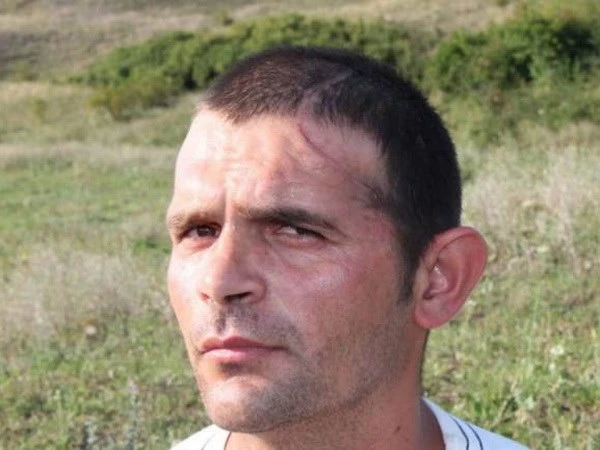 Tái tạo hộp sọ thành công cho người đàn ông mất gần nửa đầu ảnh 1